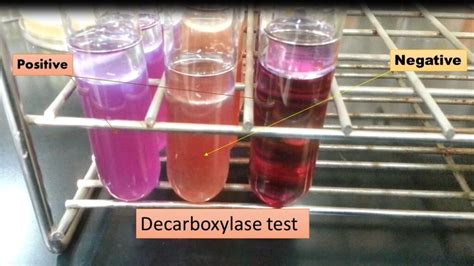 decarboxylase tests results.